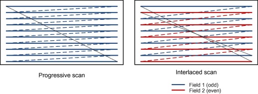 progressive vs interlaced